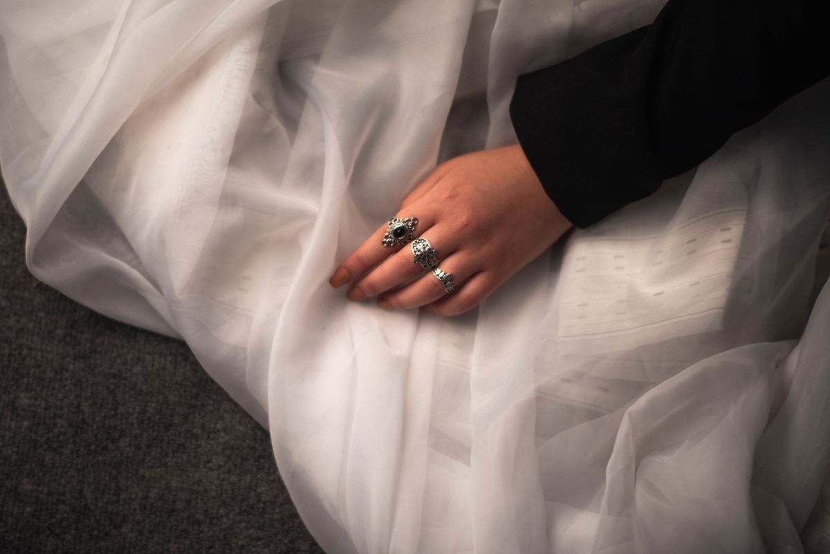 A close-up of a hand with clean, healthy skin wearing hypoallergenic 925 sterling silver rings.